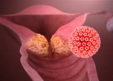 Papillomavirus e HPV DNA TEST: virus responsabile del tumore al collo dell’utero